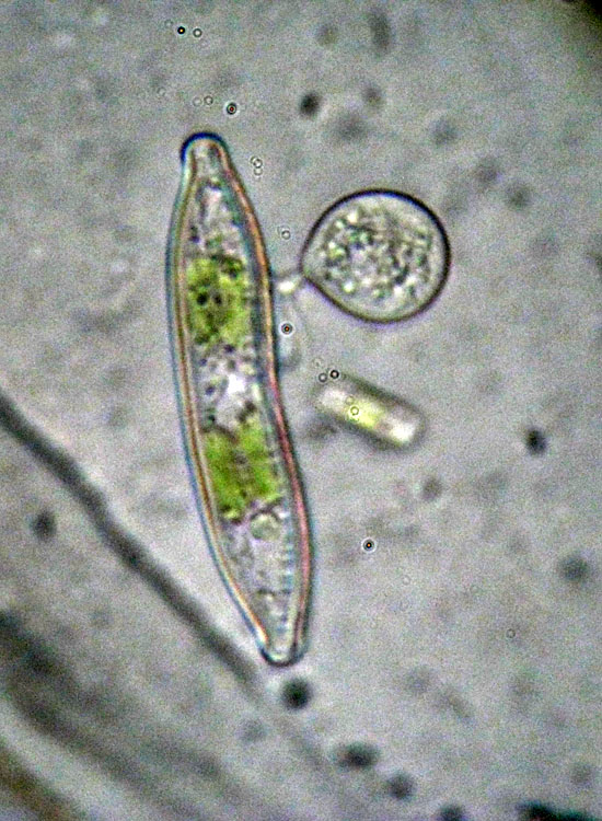 Phycomycetes su diatomea